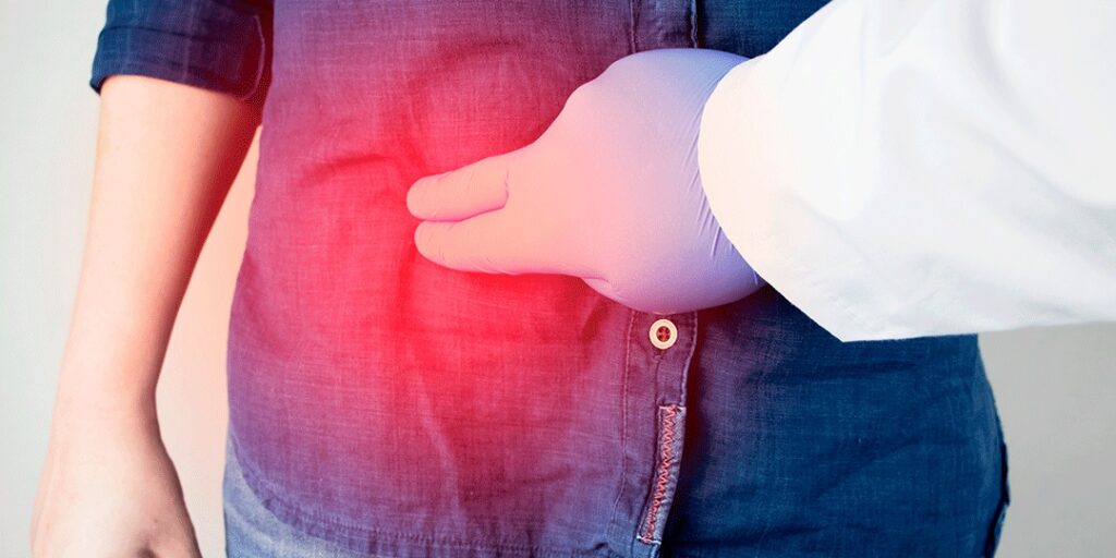 Tudo sobre a cirurgia de endometriose com retirada de parte do intestino